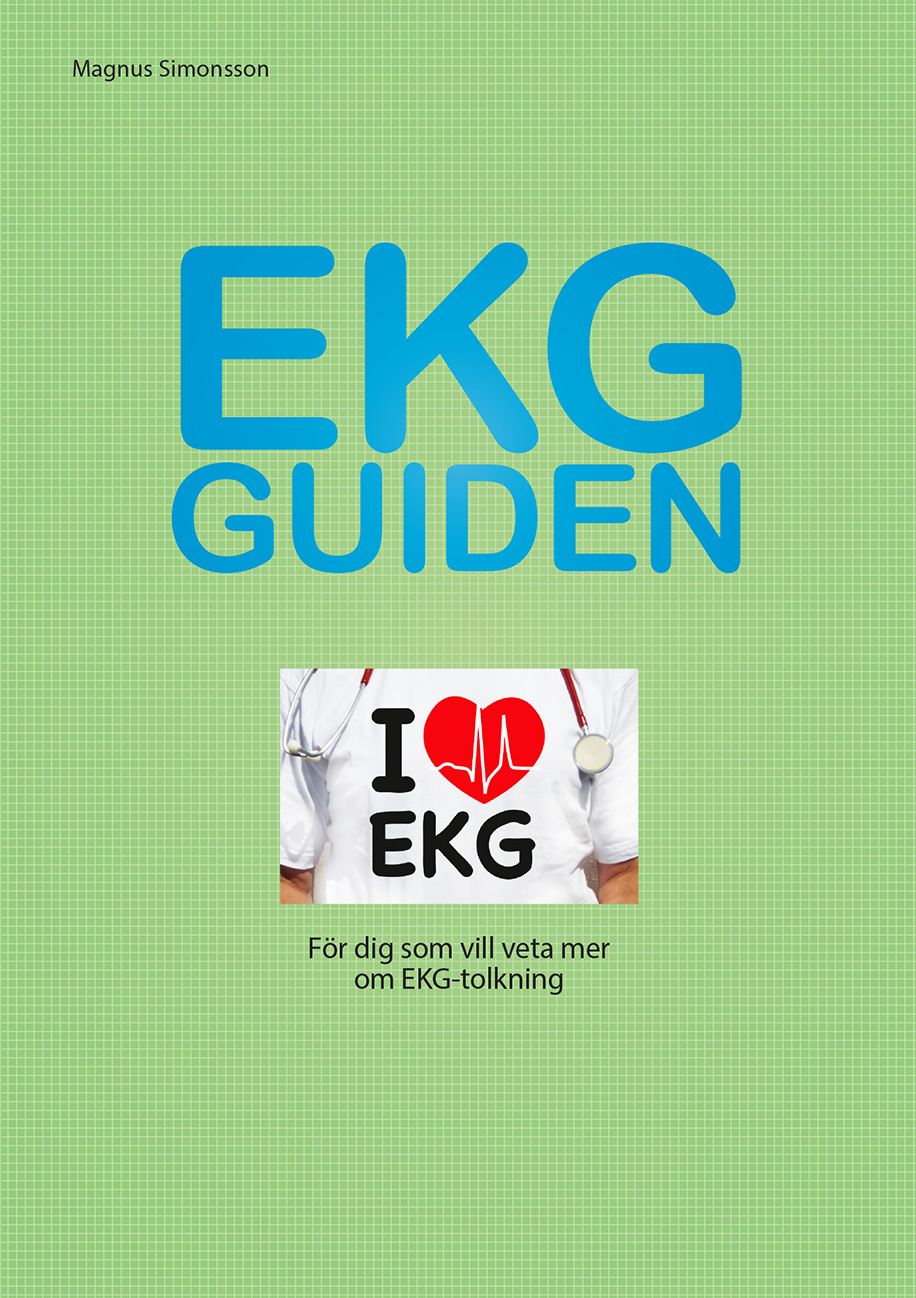 EKG Guiden