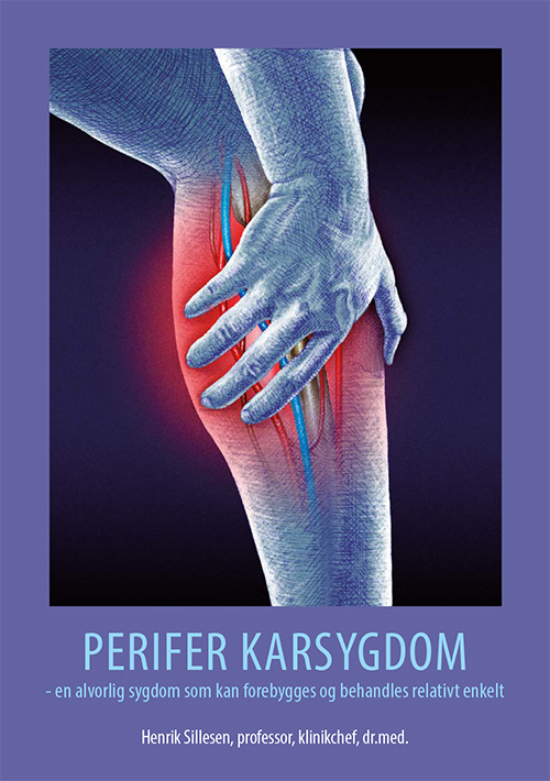 Perifer Karsygdom